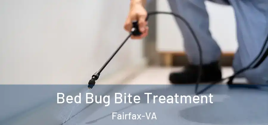 Bed Bug Bite Treatment Fairfax-VA